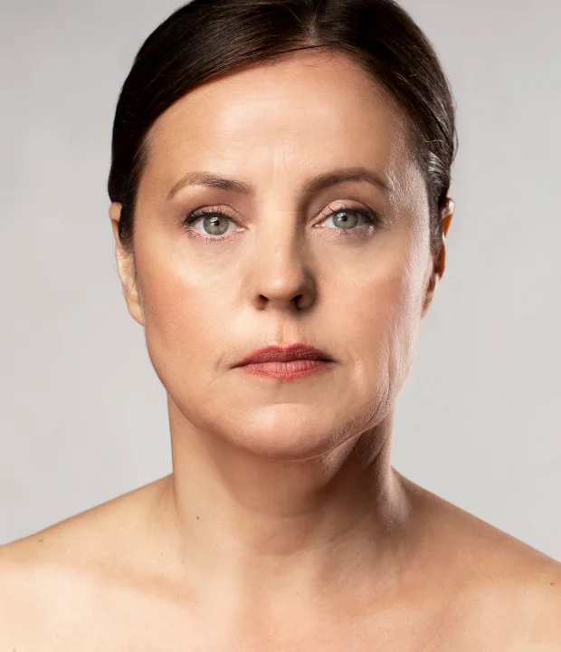 Mybodi Clinics Aesthetic body treatments