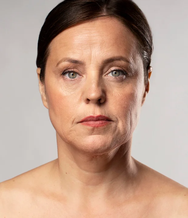 Mybodi Clinics Aesthetic body treatments